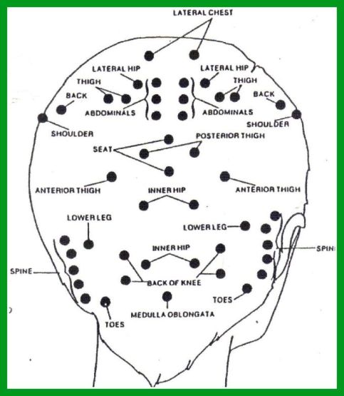 head acupuncture